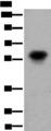 CDT1 Antibody - Western blot analysis of Human fetal brain tissue lysate  using CDT1 Polyclonal Antibody at dilution of 1:550