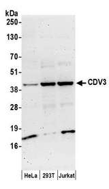 CDV3 Antibody - Detection of human CDV3 by western blot. Samples: Whole cell lysate (50 µg) from HeLa, HEK293T, and Jurkat cells prepared using NETN lysis buffer. Antibodies: Affinity purified rabbit anti-CDV3 antibody used for WB at 0.1 µg/ml. Detection: Chemiluminescence with an exposure time of 3 minutes.