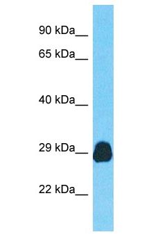 CDV3 Antibody - CDV3 antibody Western Blot of Placenta. Antibody dilution: 1 ug/ml.  This image was taken for the unconjugated form of this product. Other forms have not been tested.