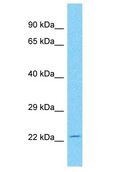 CDV3 Antibody - CDV3 antibody Western Blot of Placenta. Antibody dilution: 1 ug/ml.  This image was taken for the unconjugated form of this product. Other forms have not been tested.