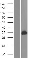 CDV3 Protein - Western validation with an anti-DDK antibody * L: Control HEK293 lysate R: Over-expression lysate