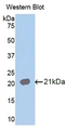 CDw218a / IL18R1 Antibody - Western blot of CDw218a / IL18R1 antibody.