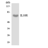 CDw218a / IL18R1 Antibody - Western blot analysis of the lysates from COLO205 cells using IL18R antibody.