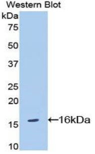 CDw218a / IL18R1 Antibody - Western blot of recombinant CDw218a / IL18R1.  This image was taken for the unconjugated form of this product. Other forms have not been tested.
