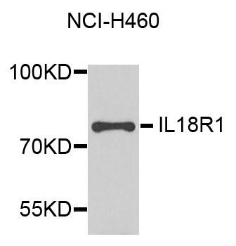 CDw218a / IL18R1 Antibody - Western blot analysis of extracts of NCI-H460 cells.