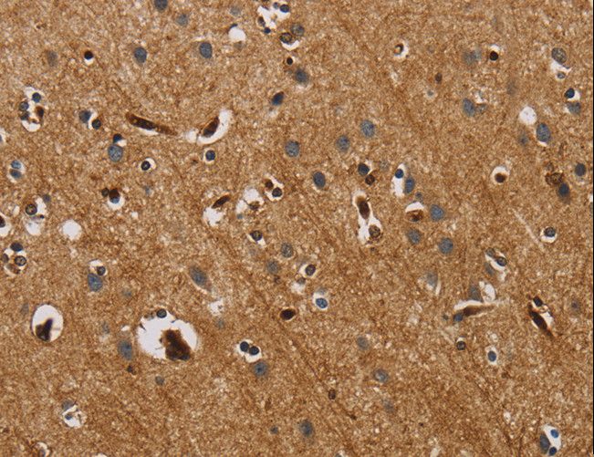CDw218a / IL18R1 Antibody - Immunohistochemistry of paraffin-embedded Human brain using IL18R1 Polyclonal Antibody at dilution of 1:40.