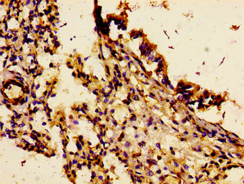 CDw218a / IL18R1 Antibody - Immunohistochemistry image of paraffin-embedded human lung tissue at a dilution of 1:100