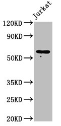 CDw218a / IL18R1 Antibody - Positive Western Blot detected in Jurkat whole cell lysate. All lanes: IL18R1 antibody at 2 µg/ml Secondary Goat polyclonal to rabbit IgG at 1/50000 dilution. Predicted band size: 63 KDa. Observed band size: 63 KDa