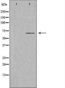 CDw218a / IL18R1 Antibody - Western blot analysis of extracts of Jurkat cells using IL18R antibody. The lane on the left is treated with the antigen-specific peptide.