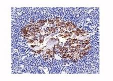 CDw75 Antibody - Formalin-fixed, paraffin-embedded normal human spleen stained with CDw75 antibody (LN1).  This image was taken for the unmodified form of this product. Other forms have not been tested.