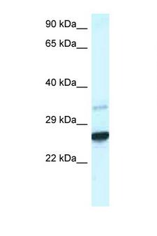 CDX1 Antibody - CDX1 antibody Western blot of Mouse Liver lysate. Antibody concentration 1 ug/ml.  This image was taken for the unconjugated form of this product. Other forms have not been tested.