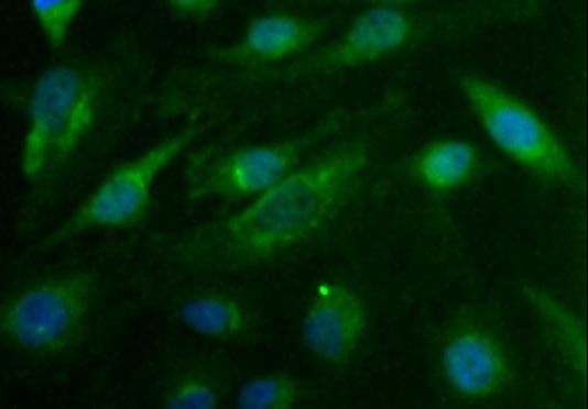 CDX1 Antibody - Immunocytochemistry/Immunofluorescence: Cdx1 Antibody - HeLa cells.  This image was taken for the unconjugated form of this product. Other forms have not been tested.