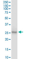 CDX1 Antibody - CDX1 monoclonal antibody (M01), clone 2D8. Western Blot analysis of CDX1 expression in human lung cancer.
