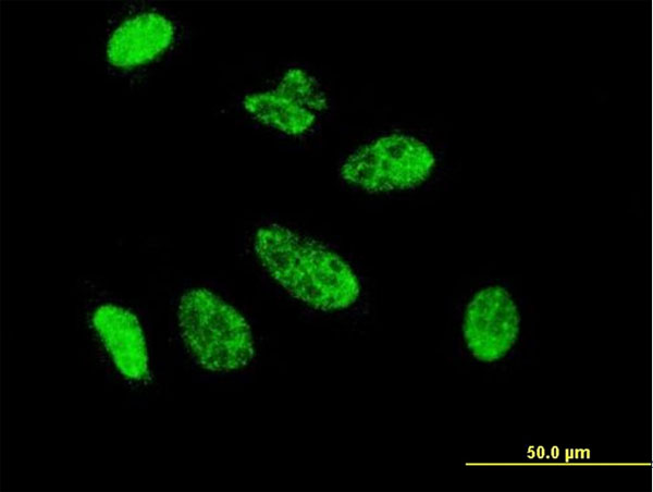 CDX1 Antibody - Immunofluorescence of monoclonal antibody to CDX1 on HeLa cell . [antibody concentration 10 ug/ml]