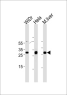 CDX1 Antibody - CDX1 Antibody western blot of WiDr,HeLa cell line and mouse liver tissue lysates (35 ug/lane). The CDX1 antibody detected the CDX1 protein (arrow).