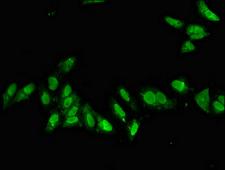 CDX1 Antibody - Immunofluorescent analysis of Hela cells diluted at 1:100 and Alexa Fluor 488-congugated AffiniPure Goat Anti-Rabbit IgG(H+L)