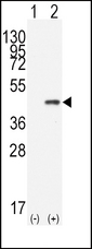 CDX2 Antibody - Western blot of CDX2(arrow) using rabbit polyclonal CDX2 Antibody. 293 cell lysates (2 ug/lane) either nontransfected (Lane 1) or transiently transfected with the CDX2 gene (Lane 2) (Origene Technologies).