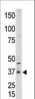 CDX2 Antibody - The anti-CDX2 N-term antibody is used in Western blot to detect CDX2 in placenta tissue lysate.