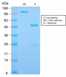 CDX2 Antibody - SDS-PAGE Analysis Purified CDX2 Rabbit Recombinant Monoclonal Antibody (CDX2/2951R). Confirmation of Purity and Integrity of Antibody.