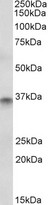 CDX2 Antibody - Goat Anti-CDX2 Antibody (1µg/ml) staining of Human Colon lysate (35µg protein in RIPA buffer). Detected by chemiluminescencence.