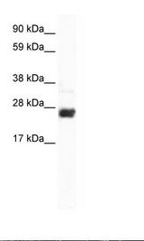 CDX2 Antibody - Fetal Liver Lysate.  This image was taken for the unconjugated form of this product. Other forms have not been tested.