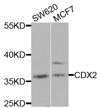 CDX2 Antibody - Western blot analysis of extracts of various cell lines, using CDX2 antibody at 1:1000 dilution. The secondary antibody used was an HRP Goat Anti-Rabbit IgG (H+L) at 1:10000 dilution. Lysates were loaded 25ug per lane and 3% nonfat dry milk in TBST was used for blocking.