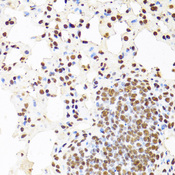 CDX2 Antibody - Immunohistochemistry of paraffin-embedded mouse lung using CDX2 antibodyat dilution of 1:100 (40x lens).