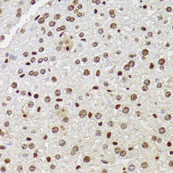 CDX2 Antibody - Immunohistochemistry of paraffin-embedded mouse liver using CDX2 antibodyat dilution of 1:100 (40x lens).