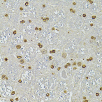 CDX2 Antibody - Immunohistochemistry of paraffin-embedded mouse brain using CDX2 antibodyat dilution of 1:100 (40x lens).
