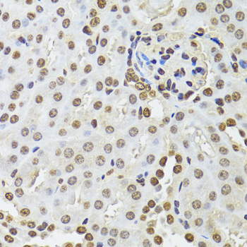 CDX2 Antibody - Immunohistochemistry of paraffin-embedded mouse kidney using CDX2 antibodyat dilution of 1:100 (40x lens).