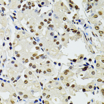 CDX2 Antibody - Immunohistochemistry of paraffin-embedded human stomach using CDX2 antibodyat dilution of 1:100 (40x lens).
