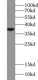 CDX2 Antibody - MCF-7 cells were subjected to SDS PAGE followed by western blot with anti-CDX2 antibody at dilution of 1:1000