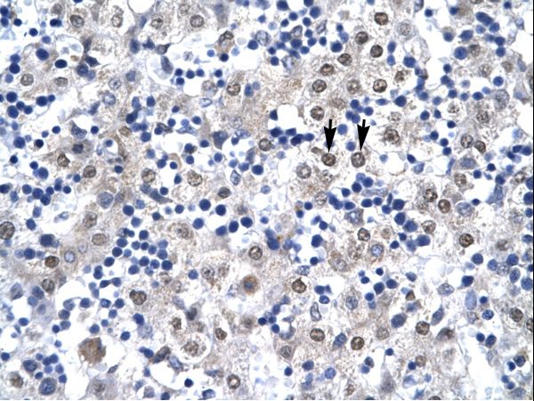 CDX4 Antibody - CDX4 antibody ARP32765_P050-NP_005184-CDX4 (caudal type homeobox transcription factor 4) Antibody was used in IHC to stain formalin-fixed, paraffin-embedded human liver.  This image was taken for the unconjugated form of this product. Other forms have not been tested.