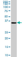 CDX4 Antibody - CDX4 monoclonal antibody (M01), clone 1G12. Western Blot analysis of CDX4 expression in PC-12.