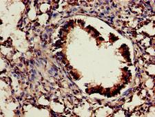 CDX4 Antibody - Immunohistochemistry of paraffin-embedded human lung tissue using CDX4 Antibody at dilution of 1:100
