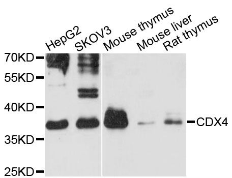 CDX4 Antibody - Western blot analysis of extracts of various cell lines, using CDX4 antibody at 1:3000 dilution. The secondary antibody used was an HRP Goat Anti-Rabbit IgG (H+L) at 1:10000 dilution. Lysates were loaded 25ug per lane and 3% nonfat dry milk in TBST was used for blocking. An ECL Kit was used for detection and the exposure time was 60s.