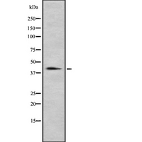 CDX4 Antibody - Western blot analysis of CDX4 using HT29 whole cells lysates