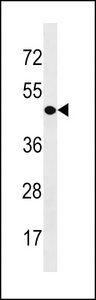 CDY1 Antibody - CDY1 Antibody western blot of A549 cell line lysates (35 ug/lane). The CDY1 antibody detected the CDY1 protein (arrow).