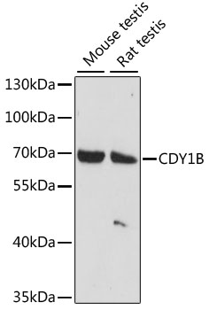 CDY1 Antibody - Western blot analysis of extracts of various cell lines, using CDY1B antibody at 1:1000 dilution. The secondary antibody used was an HRP Goat Anti-Rabbit IgG (H+L) at 1:10000 dilution. Lysates were loaded 25ug per lane and 3% nonfat dry milk in TBST was used for blocking. An ECL Kit was used for detection and the exposure time was 30s.