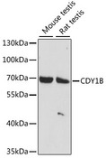 CDY1 Antibody - Western blot analysis of extracts of various cell lines, using CDY1B antibody at 1:1000 dilution. The secondary antibody used was an HRP Goat Anti-Rabbit IgG (H+L) at 1:10000 dilution. Lysates were loaded 25ug per lane and 3% nonfat dry milk in TBST was used for blocking. An ECL Kit was used for detection and the exposure time was 30s.