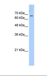 CDY2A / CDY Antibody - HepG2 cell lysate. Antibody concentration: 2.5 ug/ml. Gel concentration: 12%.  This image was taken for the unconjugated form of this product. Other forms have not been tested.