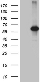 CDY2B Antibody - HEK293T cells were transfected with the pCMV6-ENTRY control. (Left lane) or pCMV6-ENTRY CDY2B. (Right lane) cDNA for 48 hrs and lysed. Equivalent amounts of cell lysates. (5 ug per lane) were separated by SDS-PAGE and immunoblotted with anti-CDY2B. (1:2000)