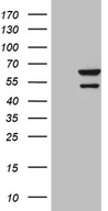 CDY2B Antibody - HEK293T cells were transfected with the pCMV6-ENTRY control. (Left lane) or pCMV6-ENTRY CDY2B. (Right lane) cDNA for 48 hrs and lysed