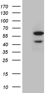CDY2B Antibody - HEK293T cells were transfected with the pCMV6-ENTRY control. (Left lane) or pCMV6-ENTRY CDY2B. (Right lane) cDNA for 48 hrs and lysed. Equivalent amounts of cell lysates. (5 ug per lane) were separated by SDS-PAGE and immunoblotted with anti-CDY2B. (1:500)