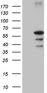 CDY2B Antibody - HEK293T cells were transfected with the pCMV6-ENTRY control. (Left lane) or pCMV6-ENTRY CDY2B. (Right lane) cDNA for 48 hrs and lysed. Equivalent amounts of cell lysates. (5 ug per lane) were separated by SDS-PAGE and immunoblotted with anti-CDY2B. (1:2000)