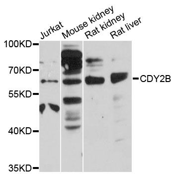 CDY2B Antibody - Western blot analysis of extracts of various cell lines, using CDY2B antibody at 1:3000 dilution. The secondary antibody used was an HRP Goat Anti-Rabbit IgG (H+L) at 1:10000 dilution. Lysates were loaded 25ug per lane and 3% nonfat dry milk in TBST was used for blocking. An ECL Kit was used for detection and the exposure time was 30s.