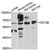 CDY2B Antibody - Western blot analysis of extracts of various cell lines, using CDY2B antibody at 1:3000 dilution. The secondary antibody used was an HRP Goat Anti-Rabbit IgG (H+L) at 1:10000 dilution. Lysates were loaded 25ug per lane and 3% nonfat dry milk in TBST was used for blocking. An ECL Kit was used for detection and the exposure time was 30s.
