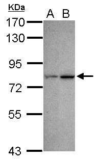 CDYL Antibody - Sample (30 ug of whole cell lysate) A: NT2D1 B: U87-MG 7.5% SDS PAGE CDYL antibody diluted at 1:500