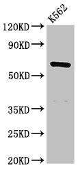 CDYL Antibody - Western Blot Positive WB detected in: K562 whole cell lysate All lanes: CDYL antibody at 3µg/ml Secondary Goat polyclonal to rabbit IgG at 1/50000 dilution Predicted band size: 67, 61, 35, 46 kDa Observed band size: 67 kDa
