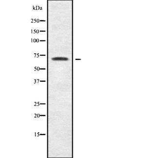CDYL Antibody - Western blot analysis of CDYL1 using HuvEc whole cells lysates
